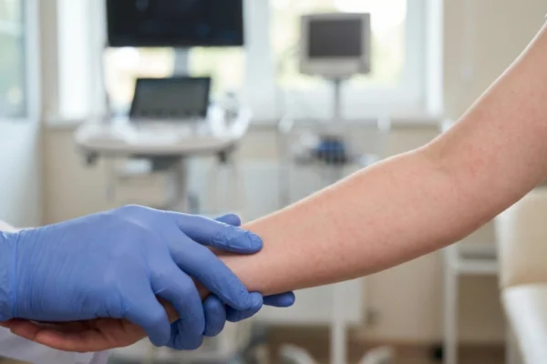A close-up shot of a patient's forearm under bright, cold clinical lighting. A healthcare professional's hand, wearing a textured bright blue nitrile glove, gently supports the patient's arm, which displays a fine, diffuse pink rash. The composition focuses sharply on the skin's texture and the rash, while the background is heavily blurred, showing the silhouettes of modern medical monitors and a bright, airy office space.