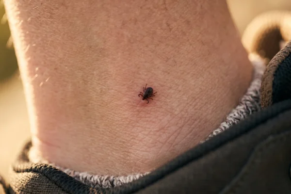 A macro, extreme close-up composition focusing on a small dark tick attached to human skin. The image is bathed in warm, soft golden hour side-lighting that emphasizes the fine skin texture and tiny hairs. The lower edge of the frame features the thick, woven texture of a grey wool sock and the dark, padded collar of a hiking boot fading into a shallow depth of field. The background consists of a smooth, golden-toned cinematic bokeh. There is no text visible in the image.